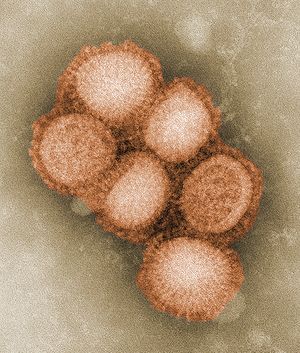  A/H1N1   .    80-120 nm